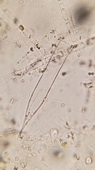 Helicostomella