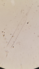 Helicostomella