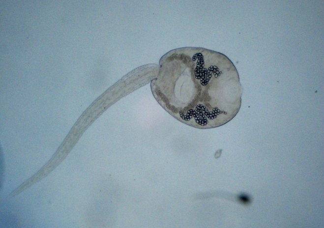 Endoparasitic Flukes