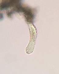 Gastrotricha