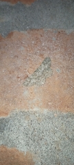 Ophthalmitis caritaria