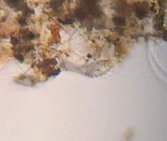 Gastrotricha