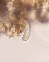 Gastrotricha