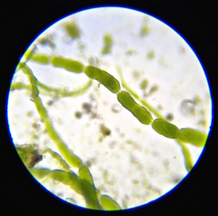 Rosenvingiellopsis constricta