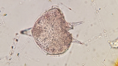 Protoperidinium