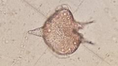 Protoperidinium