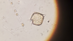 Protoperidinium