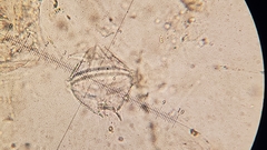 Protoperidinium