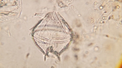 Protoperidinium