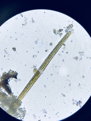 Fragilaria