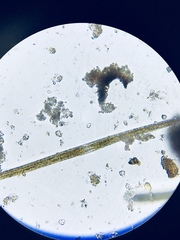Fragilaria
