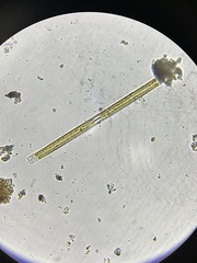 Fragilaria