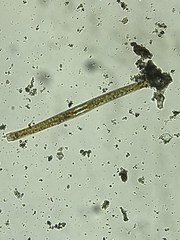 Fragilaria