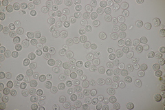 Microbotryum scabiosae