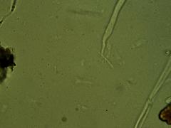 Coccomyces