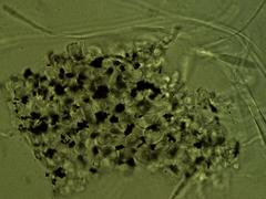 Coccomyces