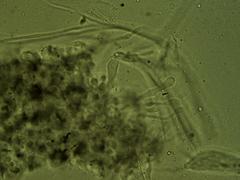 Coccomyces
