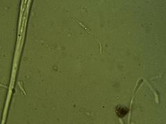 Coccomyces