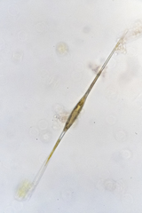 Nitzschia acicularis