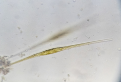 Nitzschia acicularis