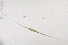 Nitzschia acicularis