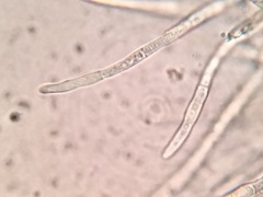 Lachnellula ellisiana
