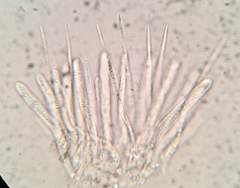 Lachnellula ellisiana