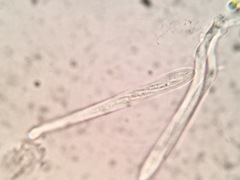 Lachnellula ellisiana