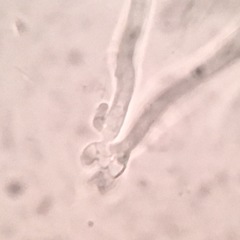 Lachnellula ellisiana