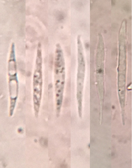 Lachnellula ellisiana
