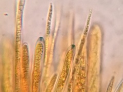 Lachnellula ellisiana