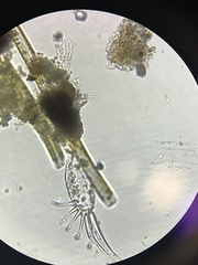 Gastrotricha