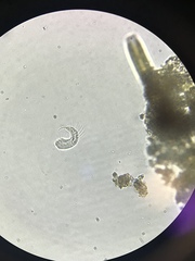 Gastrotricha
