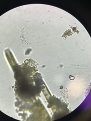 Gastrotricha