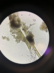 Gastrotricha