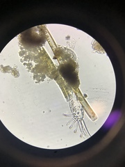 Gastrotricha