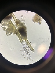 Gastrotricha