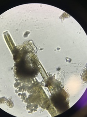 Gastrotricha