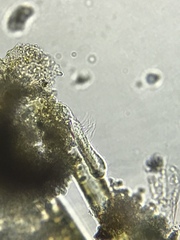 Gastrotricha