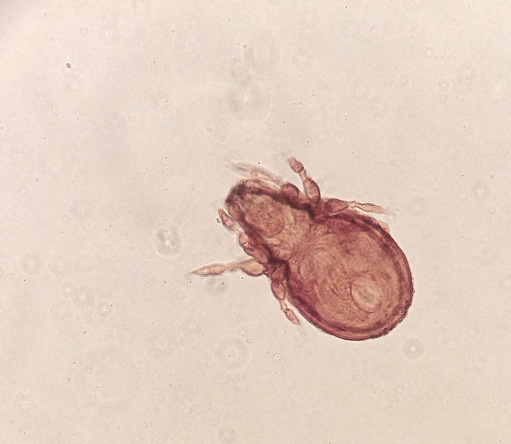 Tectocepheoidea