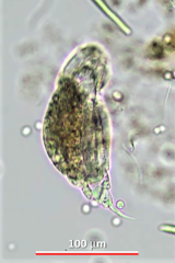 Cephalodella megalocephala