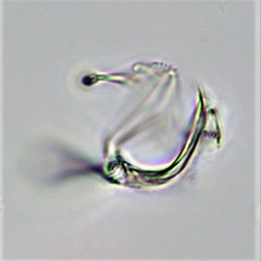 Cephalodella megalocephala