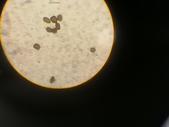 Anthracoidea caryophylleae