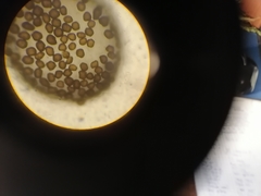 Anthracoidea caryophylleae