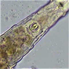 Habrotrocha collaris