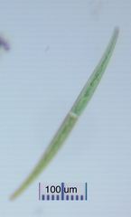 Closterium striolatum