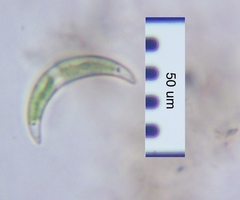 Closterium venus