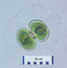 Cosmarium contractum