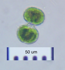 Cosmarium contractum