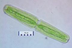 Tetmemorus brebissonii
